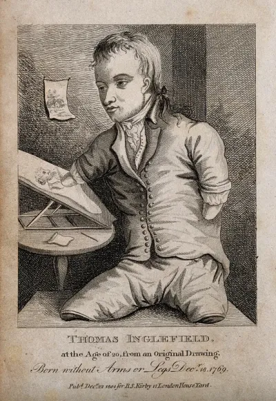 Thomas Inglefield, an artist born without limbs, aged twenty