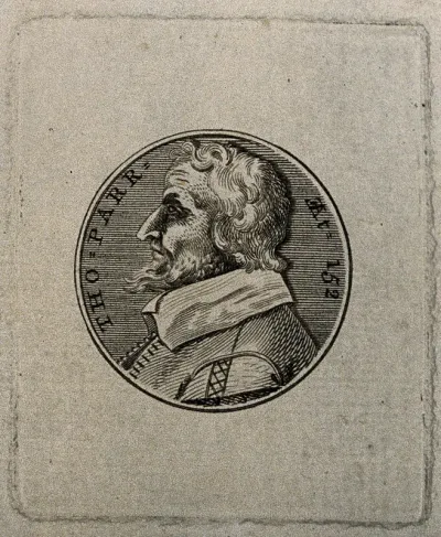 Thomas Parr, aged 152