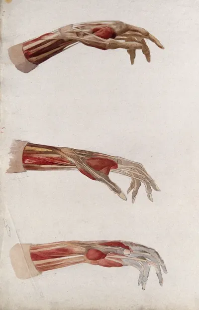 Three dissections of the right hand and wrist, showing the muscles and tendons