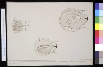 Three drawings showing the developmen of the foetus