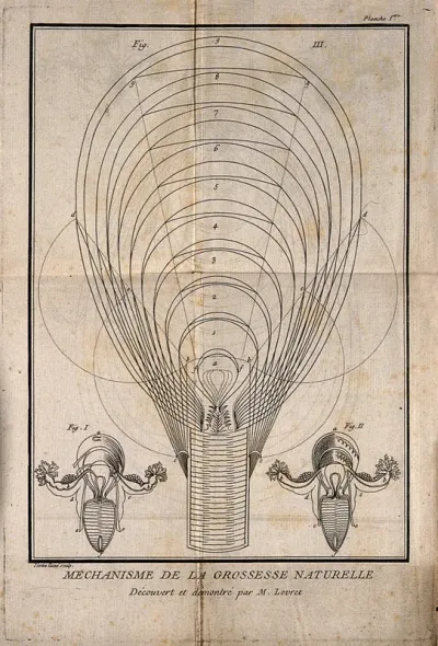 Three interior diagrams of a human uterus