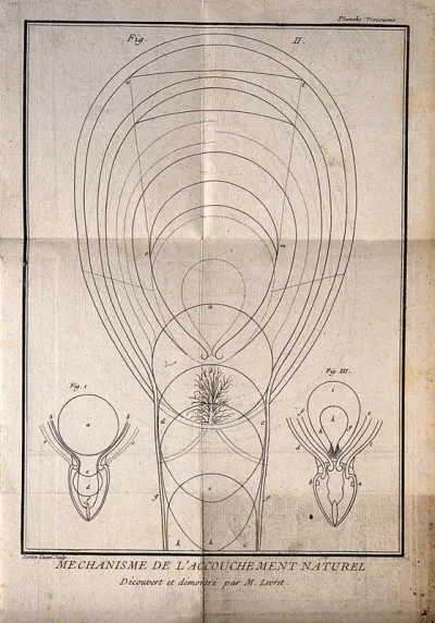 Three interior diagrams of an adult human uterus