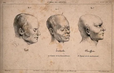 Three portraits shown for their phrenological exemplarity: Gall, Eustache and Chauffron
