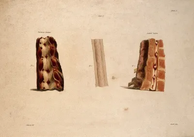 Three sections of vertebrae