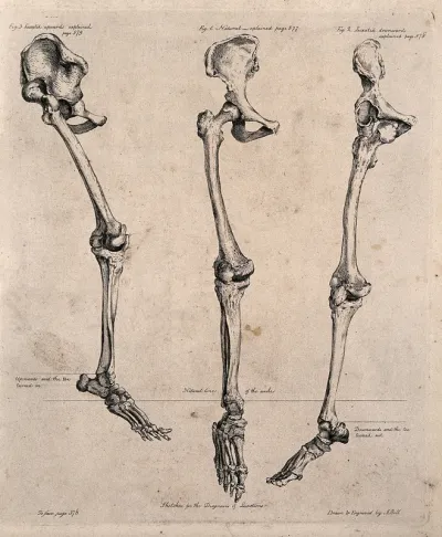 Three skeletal legs with pelvis and foot attached