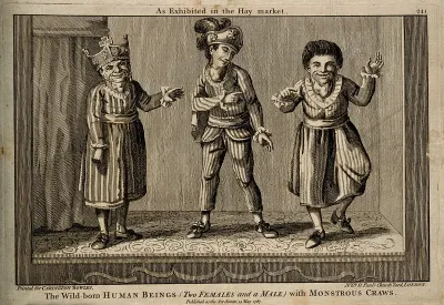 Three wild born people, all with goitre