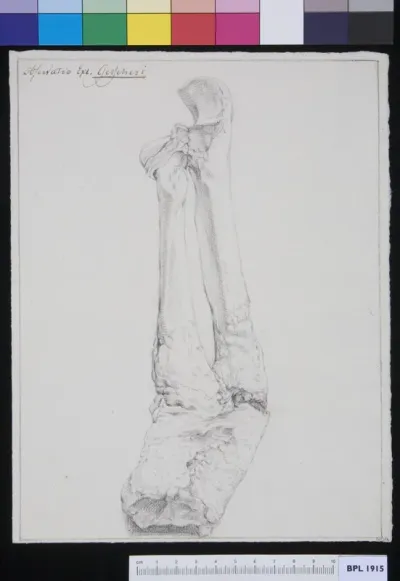 Tibia and fibula