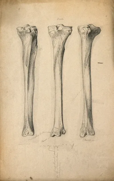 Tibia bones: three figures