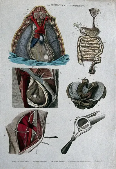 Top left, section of the heart; top right, intestines; centre left and right, hernia; bottom left, carotide; bottom right, speculum