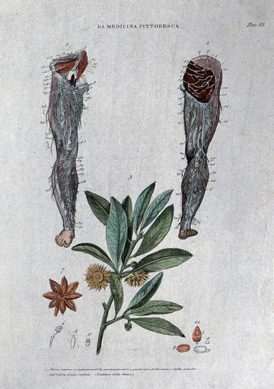 Top, nerves of the lower limb, anterior (left) and posterior (right) views; below, centre, the plant Illicium verum (Chinese star anise, badian)