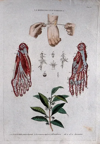 Top, surgery of the bones of the wrist; centre, arteries of the foot; bottom, the plant Ipecacuanha