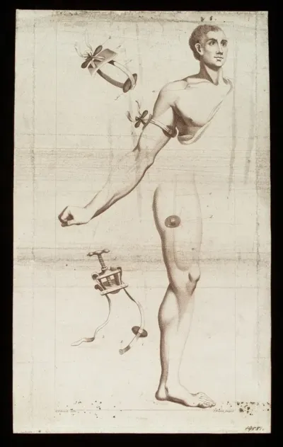 Tourniquets: strap-operated and screw-operated, for the arm and thigh