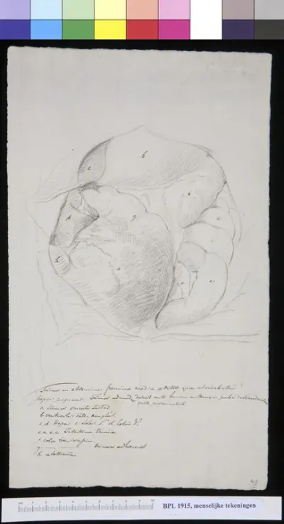Tumor in the abdomen