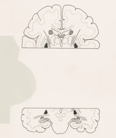 Two cross sections of the brain