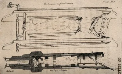 Two diagrams comparing two sets of apparatus for the leg designed by Vesalius and Belloq
