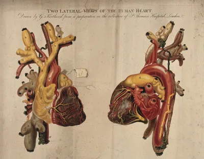 Two lateral views of the human heart