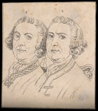 Two sketches of a man's head