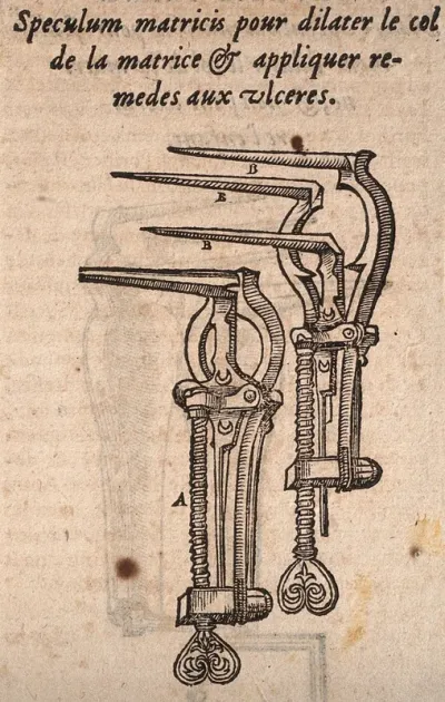 Two specula for dilating the womb and administering treatments for ulcers