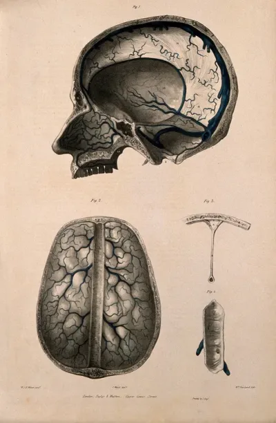 Veins of the brain (cerebral sinuses) and of the inside of the skull