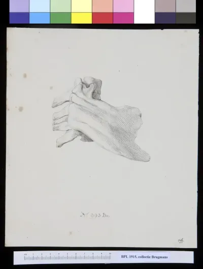 Vertebrae, deformed