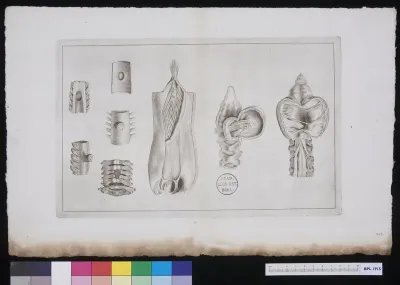 Vertebrae: infections