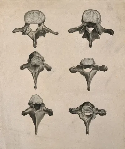 Vertebrae: six figures