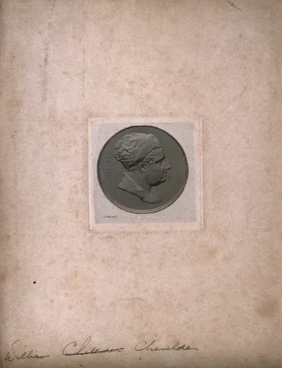 William Cheselden: profile