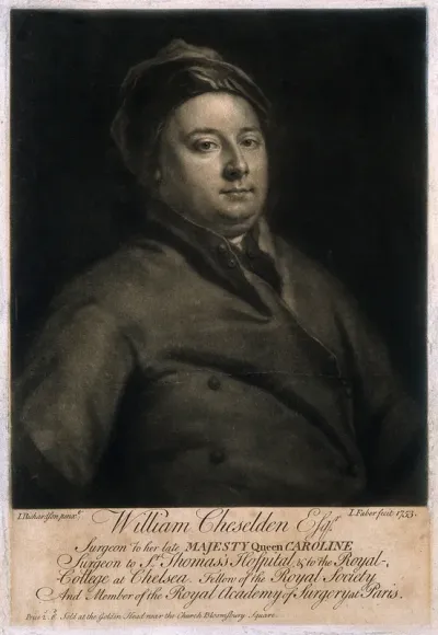 William Cheselden