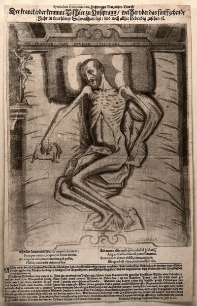 Wolfgang Gschaidtter, a carpenter at Innsbruck, paralyzed for fifteen years, with deformed feet and hands