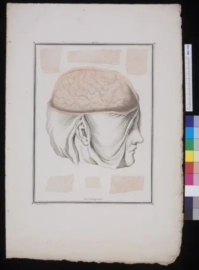 Woman's head with exposed brain