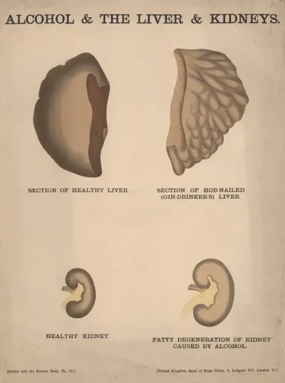Alcohol The Liver Kidneys