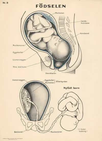 Childbirth