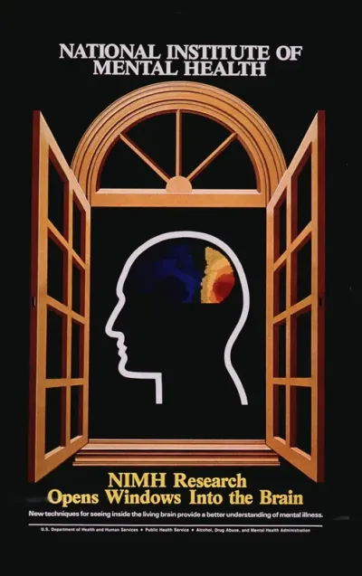 Nimh Research Opens Windows Into The Brain