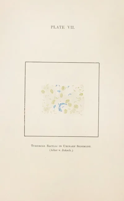Plate Vii Tubercle Bacilli In Urinary Sediment