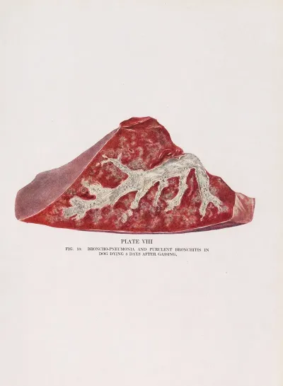 Plate Viii Fig 13 Broncho Pneumonia And Purulent Bronchitis In Dog Dying 5 Days After Gassing