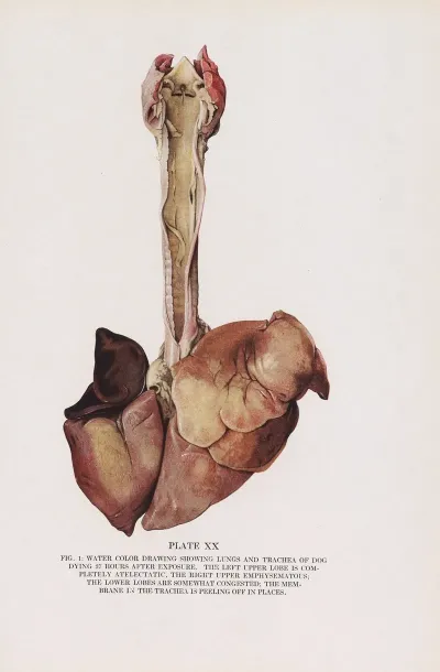 Plate Xx Fig 1 Water Color Drawing Showing Lungs And Trachea Of Dog Dying 37 Hours After Exposure