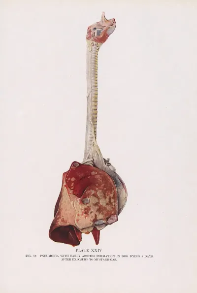 Plate Xxiv Fig 18 Pneumonia With Early Abscess Formation In Dog Dying 5 Days After Exposure To Mustard Gas