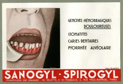 Sanogyl Spirogyl
