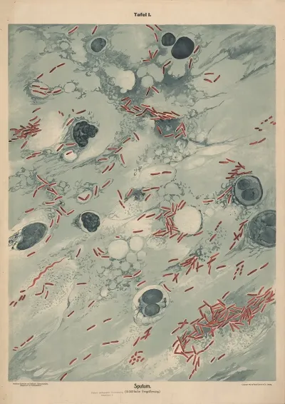 Sputum