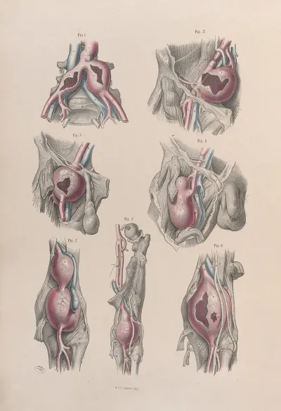 Surgical Anatomy Pl 52