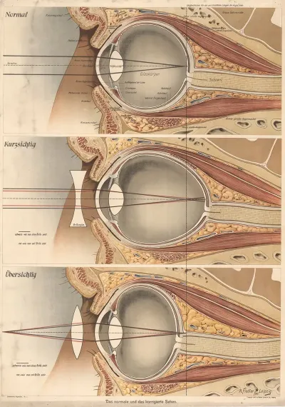 The Eye 2