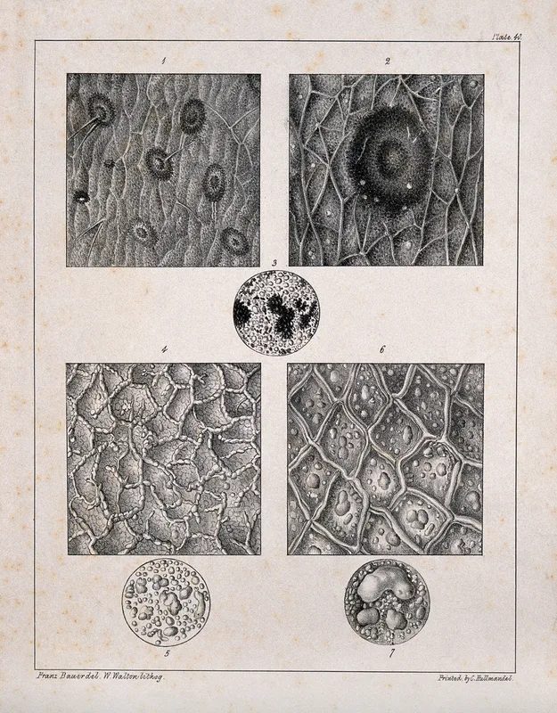 Several examples of skin disease by Franz Andreas Bauer, 1847