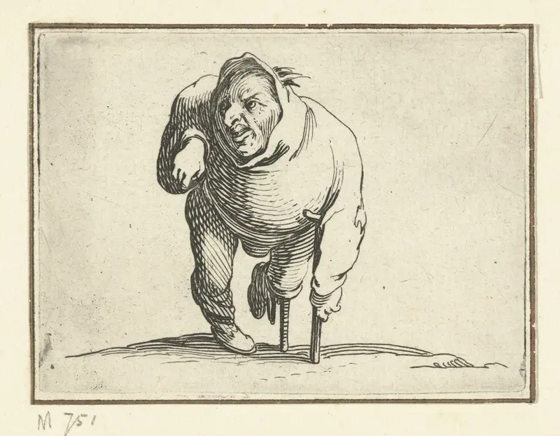 Kleine mens (karikatuur) met kruk en beensteun Wall Art by Jacques Callot - High-Resolution Digital Print