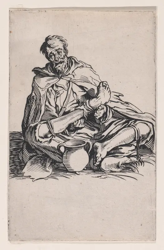 Le Malingreux (The Sickly Man), from "Les Gueux suite appelée aussi Les Mendiants, Les Baroni, ou Les Barons" (The Beggars, also called the Barons) Wall Art by Jacques Callot - High-Resolution Digital Print