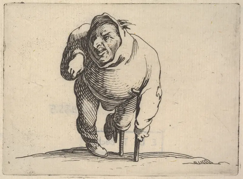 Small male figure with peg leg and crutch, in frontal view, from "Varie Figure Gobbi" Wall Art by Jacques Callot - High-Resolution Digital Print