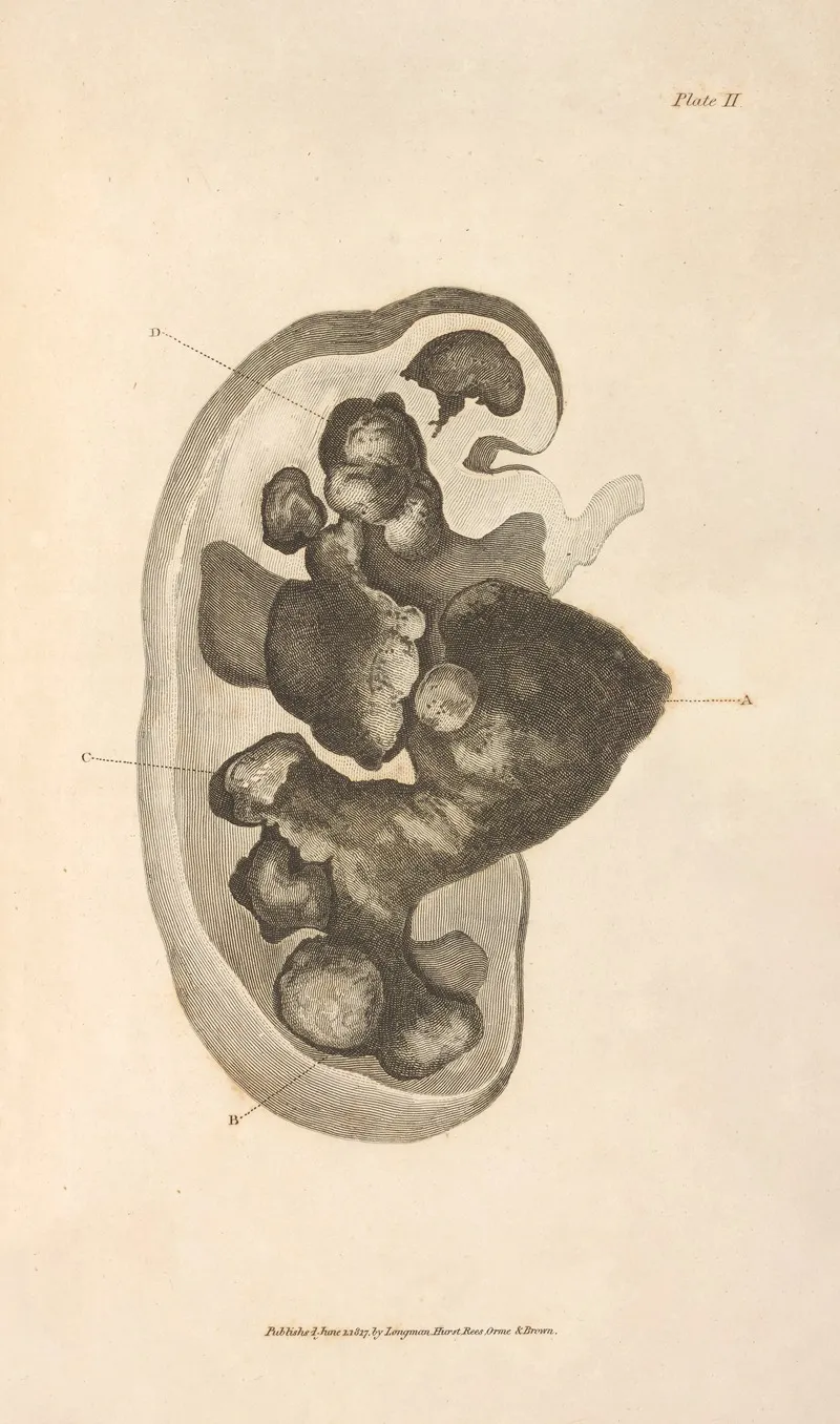 An Essay On The Chemical History And Medical Treatment Of Calculous Disorders Pl 8