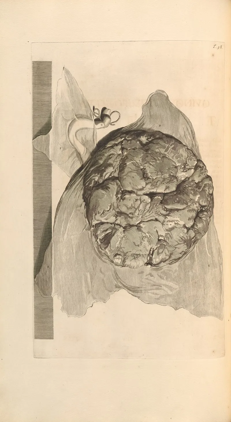 Anatomia Humani Corporis Pl 059