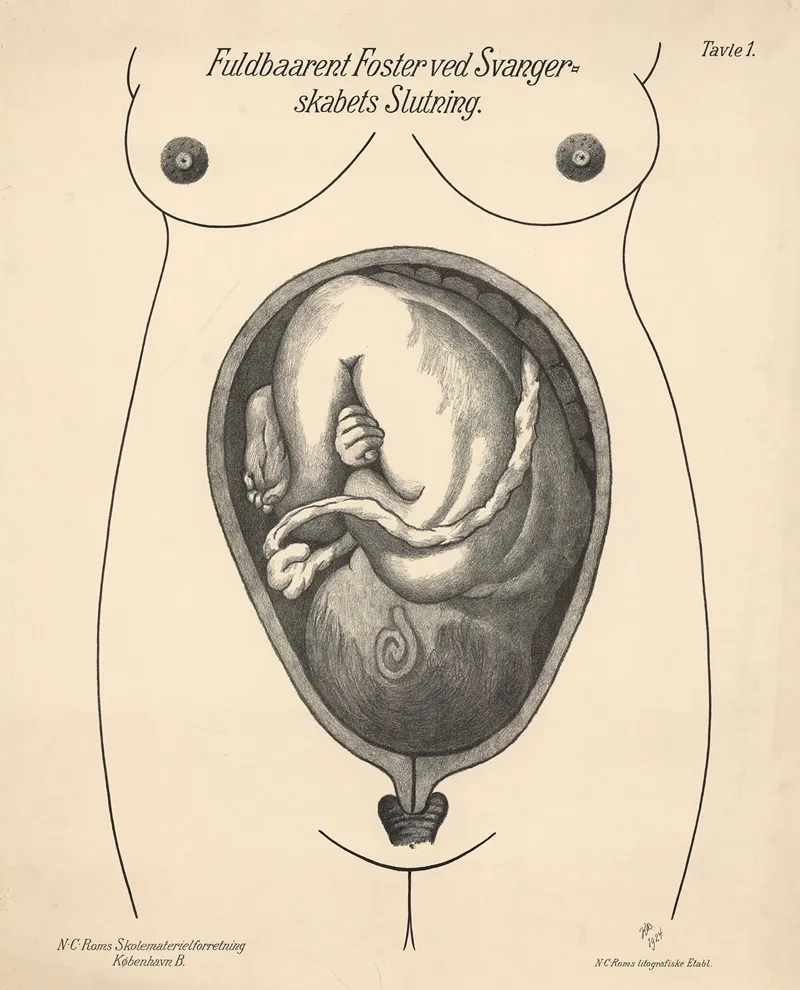 Full Term Fetus At The End Of Pregnancy by N.C. Rom - Canvas Print