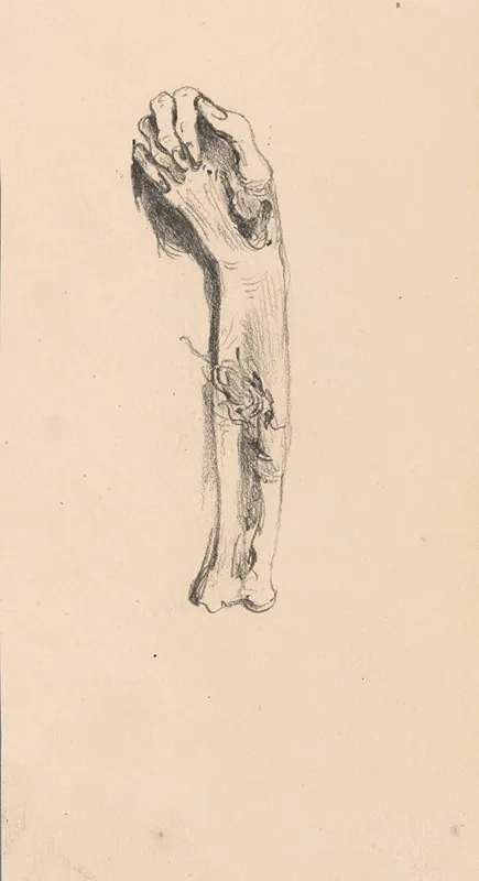 Hand And Arm