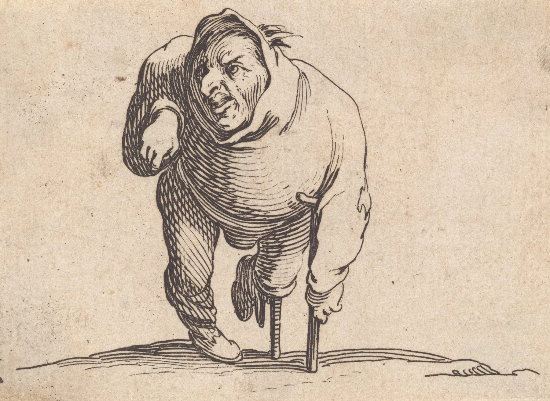 Lestropie A La Bequille Et A La Jambe De Bois